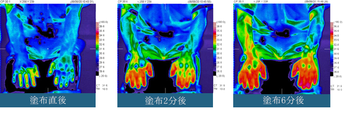 血流改善試験