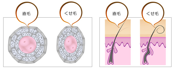 直毛とくせ毛、髪の断面図