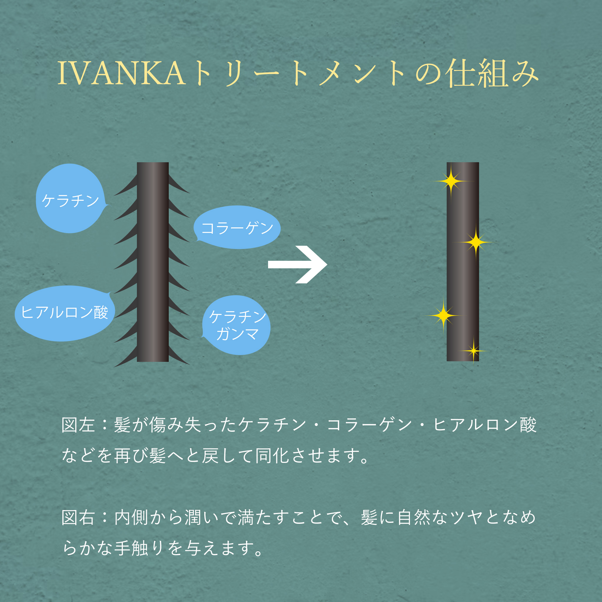 イヴァンカトリートメントの仕組み。